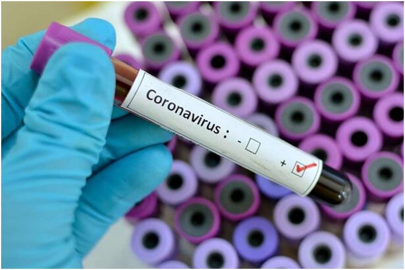 The number of the deaths from coronavirus surpasses 200,000 in the United States